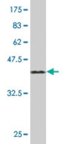 Monoclonal Anti-TCAP antibody produced in mouse