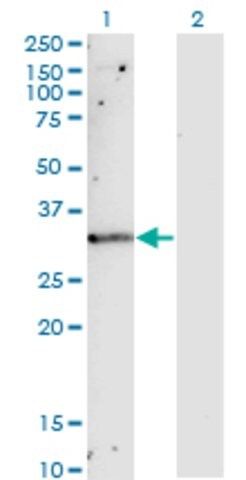 Monoclonal Anti-TIMP1 antibody produced in mouse