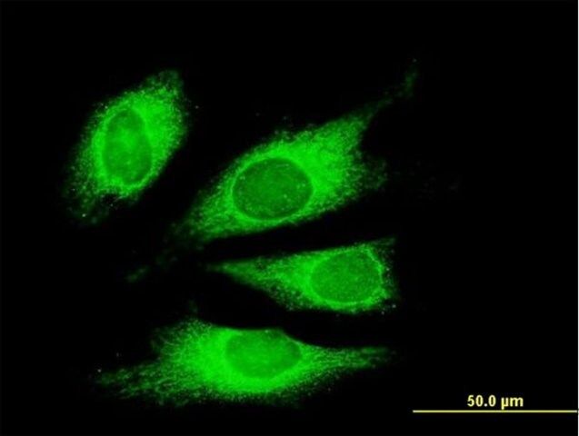 Monoclonal Anti-TG antibody produced in mouse