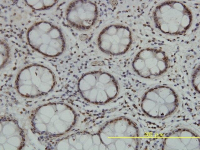 Monoclonal Anti-TLK2 antibody produced in mouse