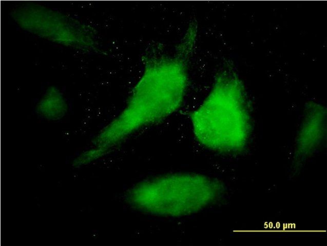 Monoclonal Anti-STAT1 antibody produced in mouse