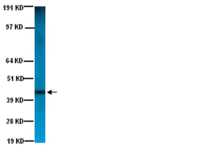 Anti-Actin Antibody, smooth muscle, clone ASM-1