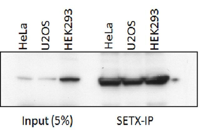 Anti-Senataxin (OY11) Antibody