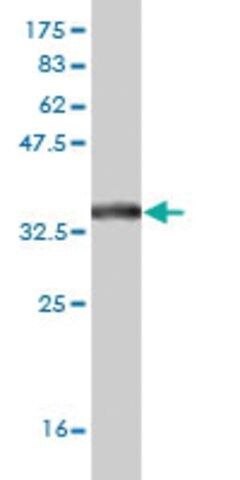 Monoclonal Anti-SLC19A2 antibody produced in mouse