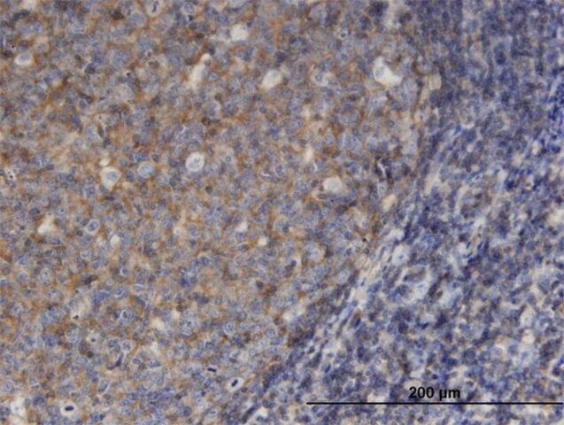 Monoclonal Anti-MSN antibody produced in mouse