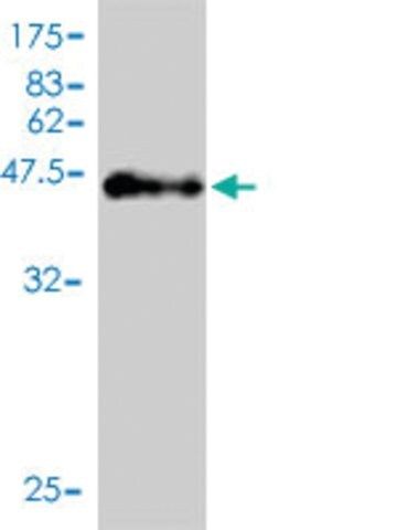 Monoclonal Anti-C1orf67 antibody produced in mouse