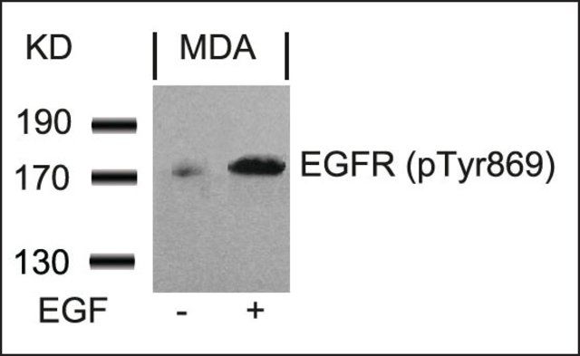 Anti-phospho-EGFR (pTyr<sup>869</sup>) antibody produced in rabbit