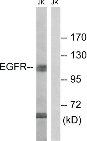Anti-EGFR antibody produced in rabbit