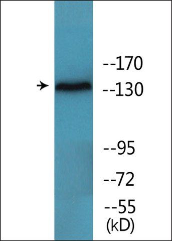 Anti-phospho-EGFR (pTyr<sup>1172</sup>) antibody produced in rabbit