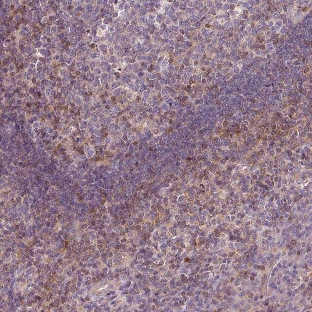 Anti-STAT5A antibody produced in rabbit