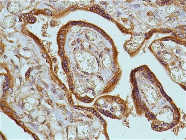 Anti-EGFR antibody, Rabbit monoclonal