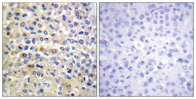 Anti-EGFR antibody produced in rabbit