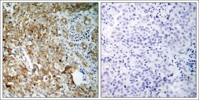 Anti-IGF1R (Ab-1161) antibody produced in rabbit