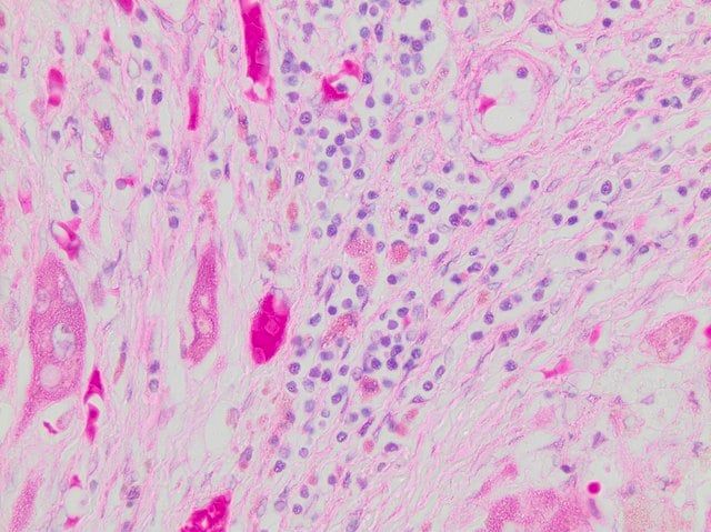 Hematoxylin Solution, Gill No. 2