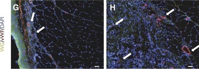 Anti-von Willebrand Factor Antibody