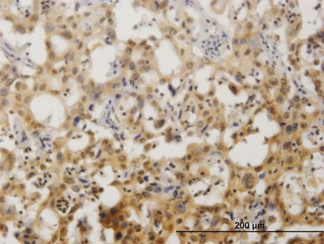 Monoclonal Anti-ZNF496 antibody produced in mouse