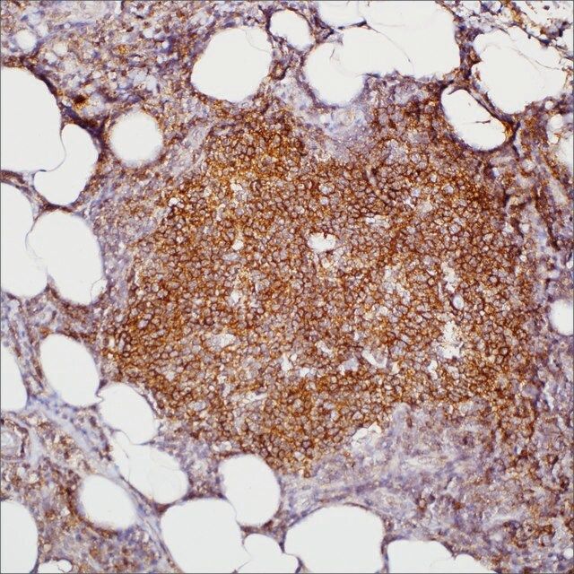HGAL (MRQ-49) Mouse Monoclonal Antibody