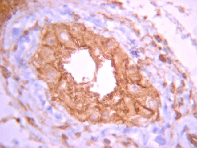 Anti-PP2A Antibody, Catalytic subunit