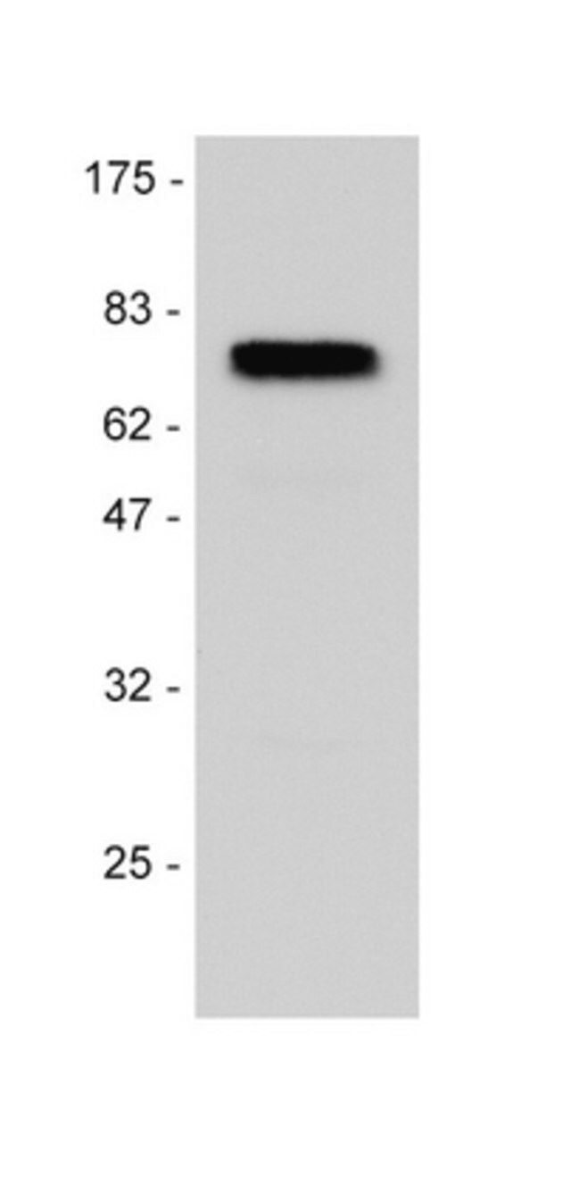 Anti-p75NTR (Neurotrophin Receptor) Antibody
