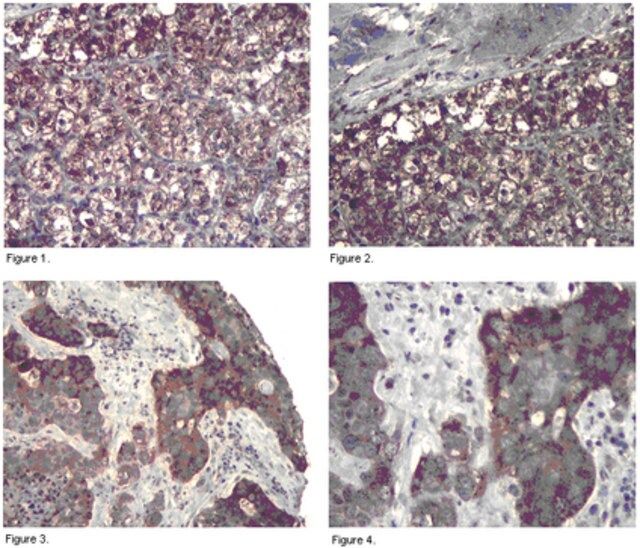 Anti-PP6R3 Antibody