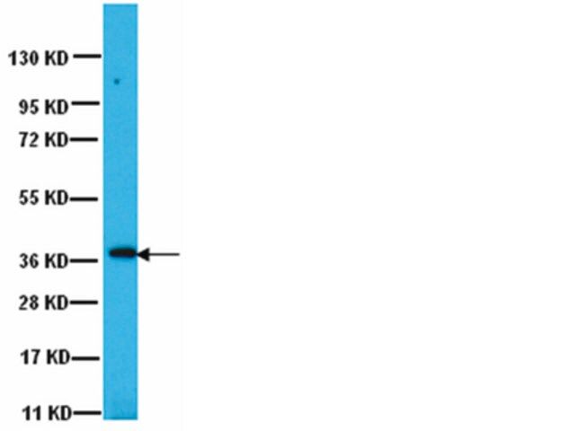 Anti-PP1γ1 Antibody