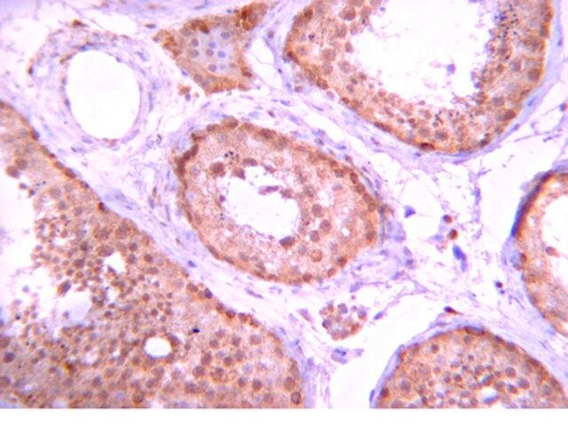 Anti-PP5 Antibody