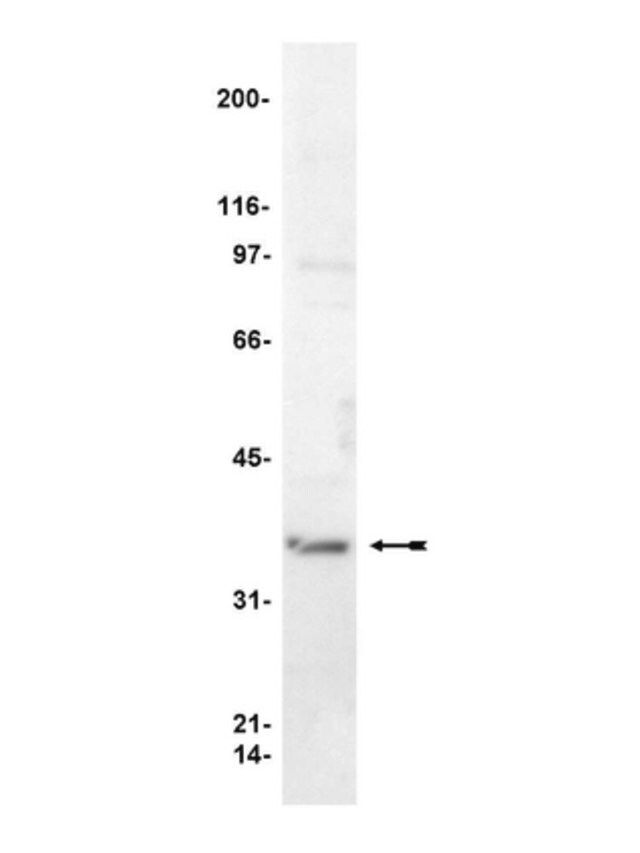 Anti-Gβ Antibody