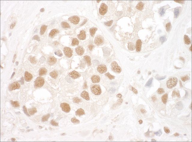 Rabbit anti-Ku80 Antibody, Affinity Purified
