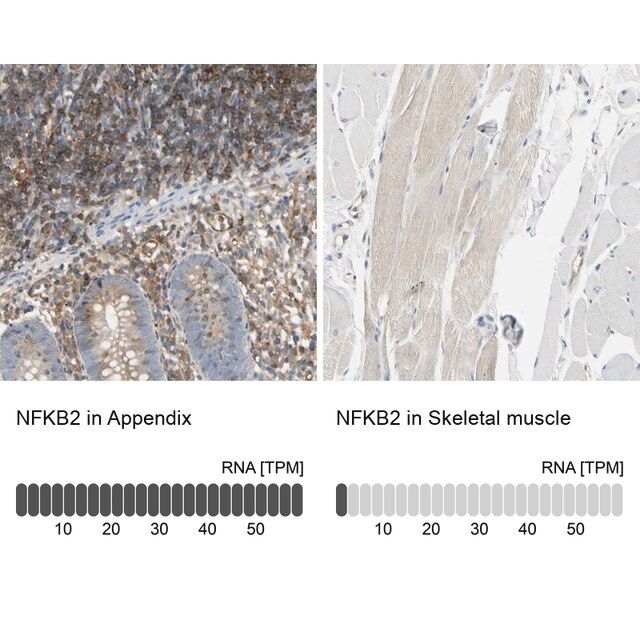 Anti-NFKB2 antibody produced in rabbit
