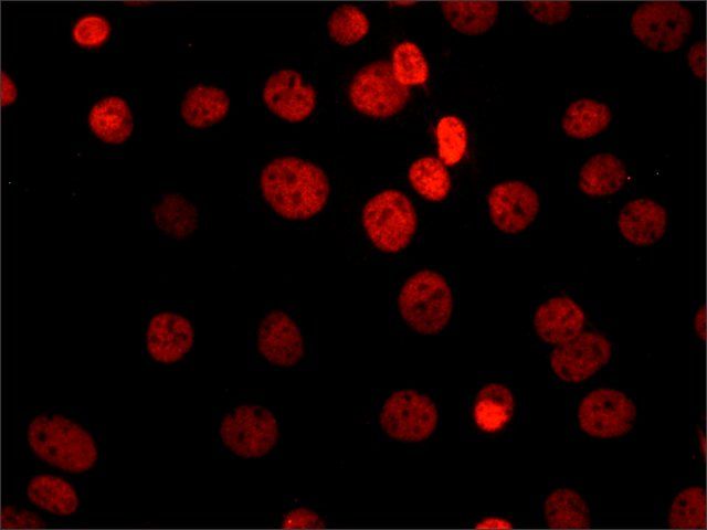 Anti-Sirt1 antibody, Mouse monoclonal