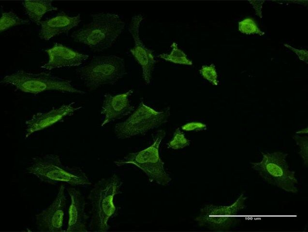 Monoclonal Anti-VCL antibody produced in mouse