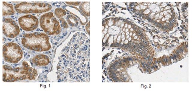 Anti-Prohibitin Antibody