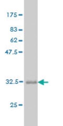 Monoclonal Anti-ALG12 antibody produced in mouse
