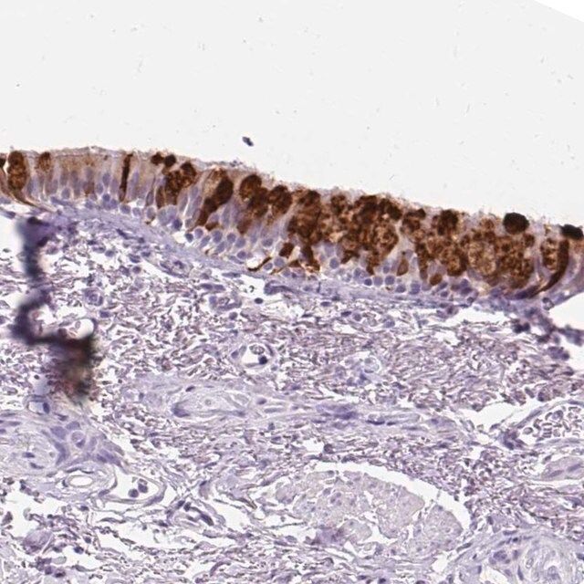 Anti-SCGB1A1 antibody produced in rabbit