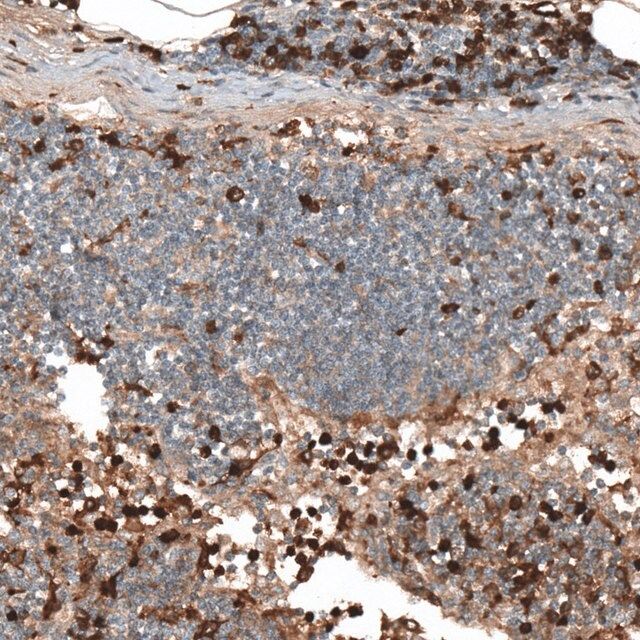 Anti-HJURP antibody produced in rabbit