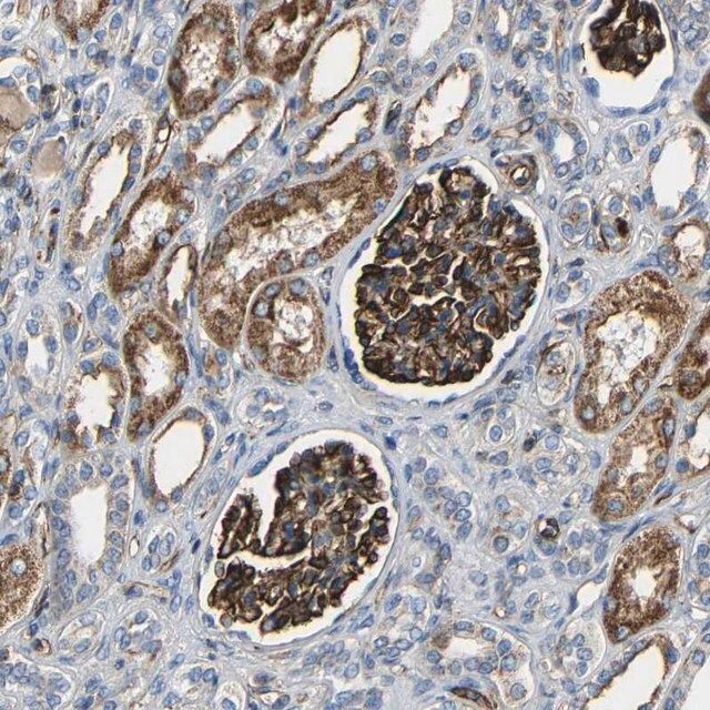 Anti-IGSF10 antibody produced in rabbit
