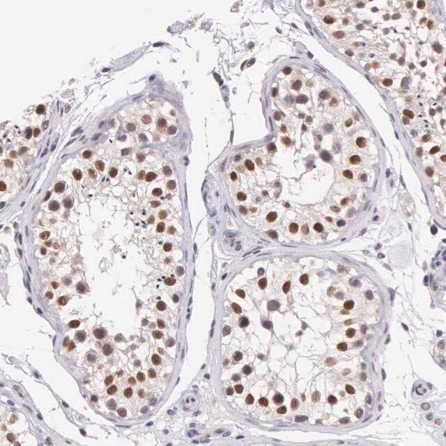 Anti-HMGXB4 antibody produced in rabbit