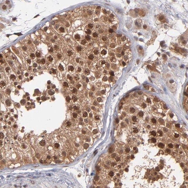 Anti-HUWE1 antibody produced in rabbit