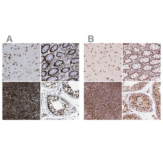Anti-ZNF207 antibody produced in rabbit