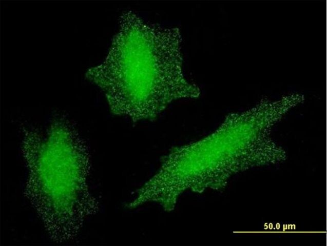 Monoclonal Anti-VHL antibody produced in mouse