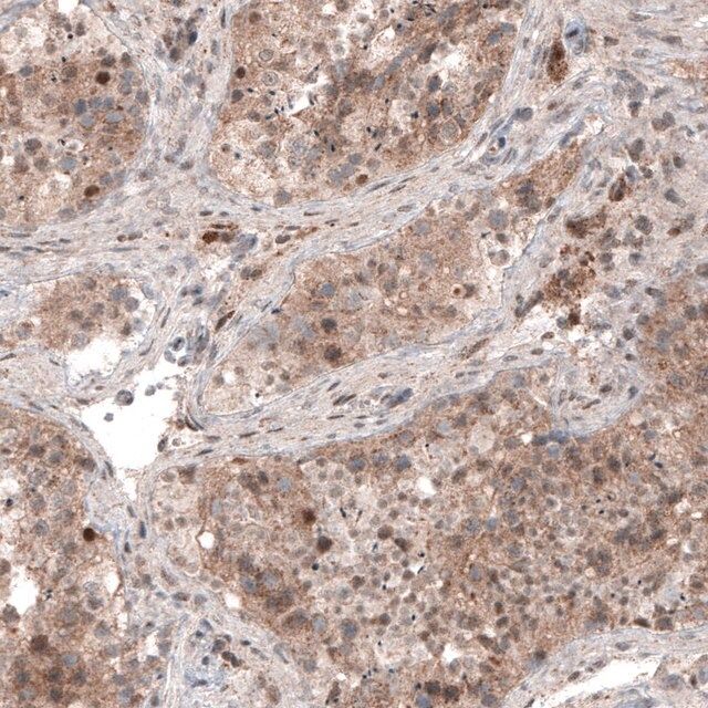 Monoclonal Anti-USP30 antibody produced in mouse