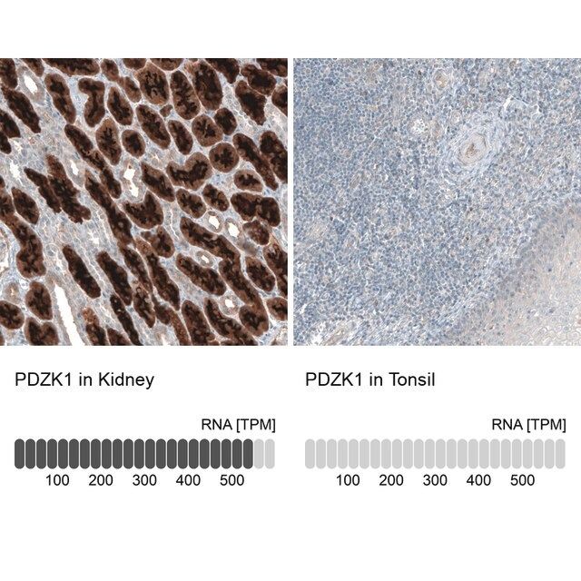 Anti-PDZK1 antibody produced in rabbit