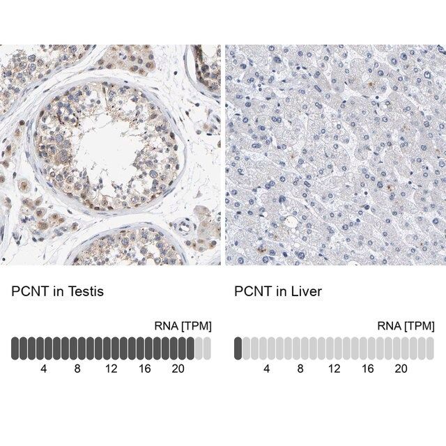 Anti-PCNT antibody produced in rabbit