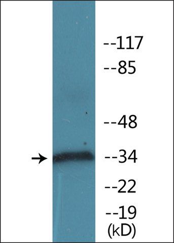 Anti-phospho-CD32 (pTyr<sup>292</sup>) antibody produced in rabbit
