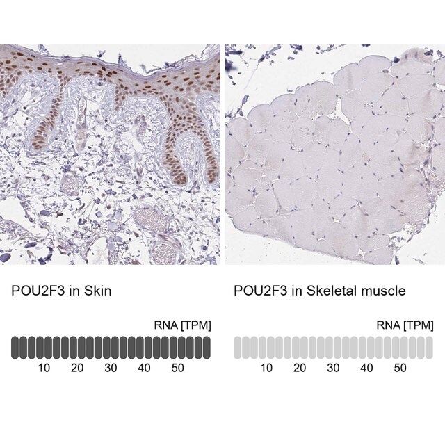 Anti-POU2F3 antibody produced in rabbit