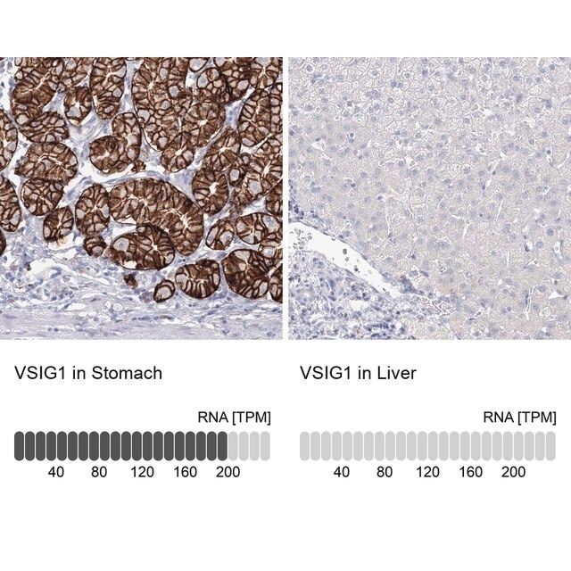 Anti-VSIG1 antibody produced in rabbit
