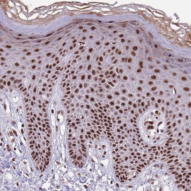 Anti-THOC2 antibody produced in rabbit