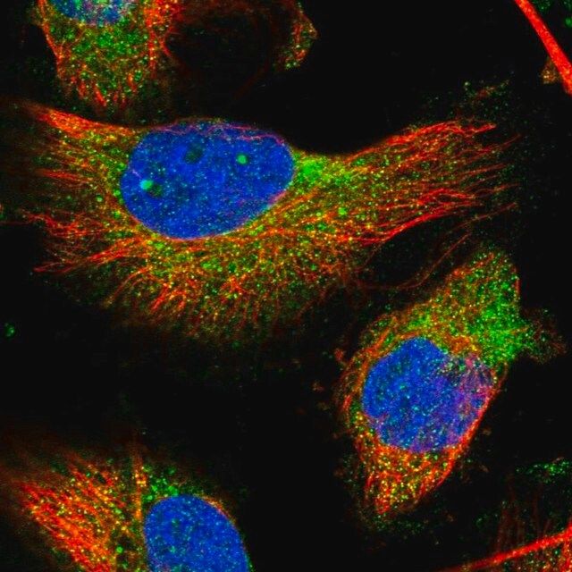 Anti-TMC3 antibody produced in rabbit