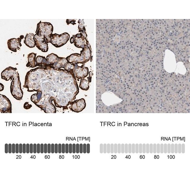 Anti-TFRC antibody produced in rabbit