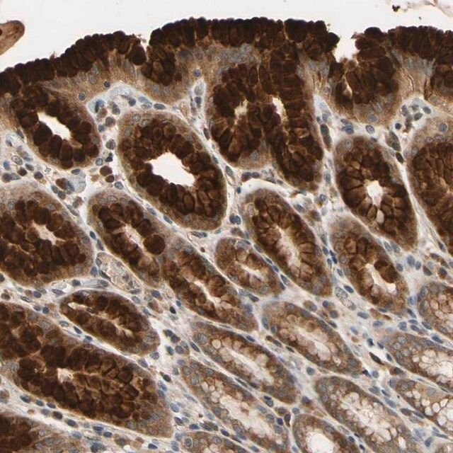 Anti-TMEM230 antibody produced in rabbit